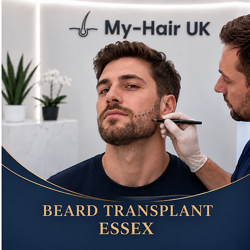 Beard Transplant for Essex Patients