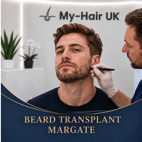 Beard Transplant for Margate Patients
