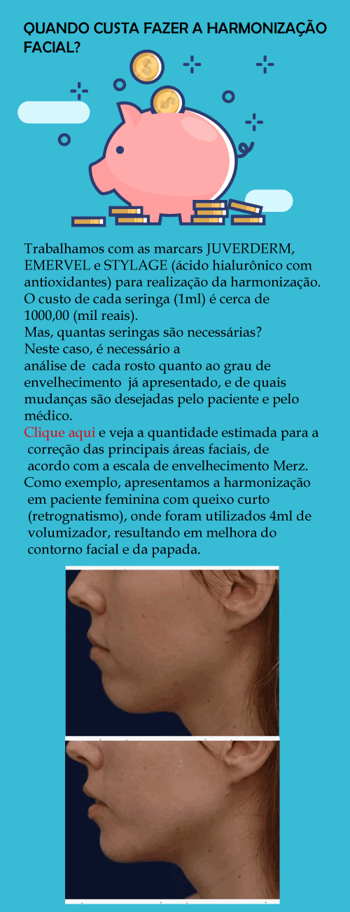 Qual o preço/valor da harmonização facial?
