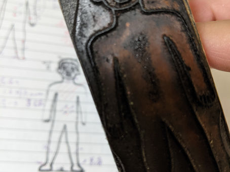 お義父さんとカルテ