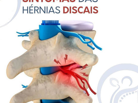 Quiropraxia na Hérnia Discal