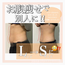 脂肪冷却2.JPG