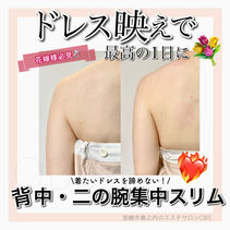 背中二の腕痩せ.JPG