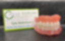 denture.jpg