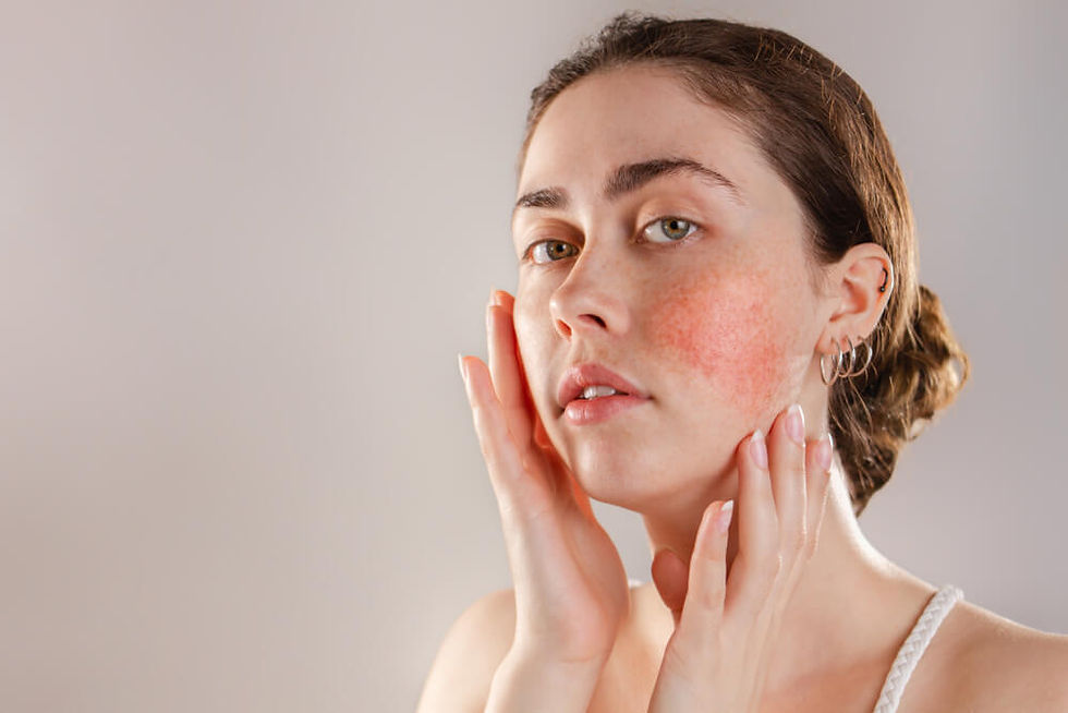 Facial redness treatment melbourne