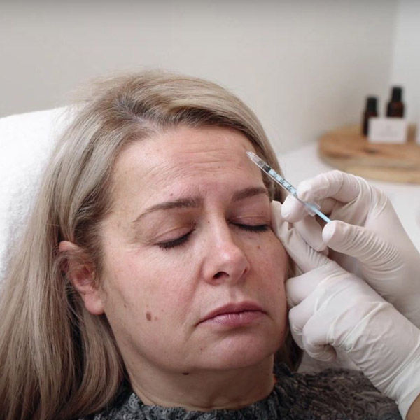 Botox injections melbourne