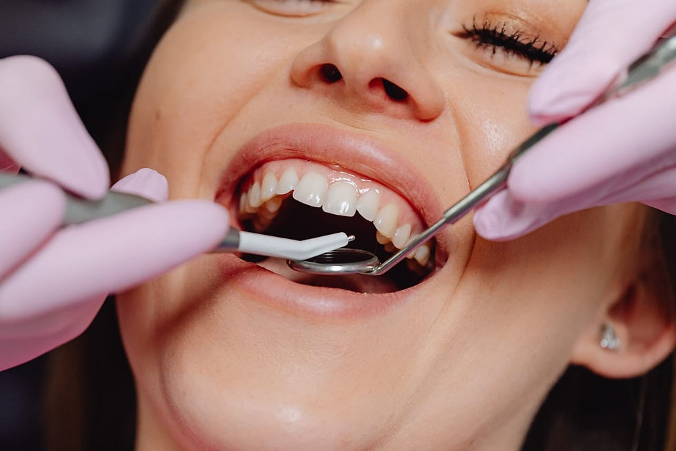 Gummy smile treatment melbourne.