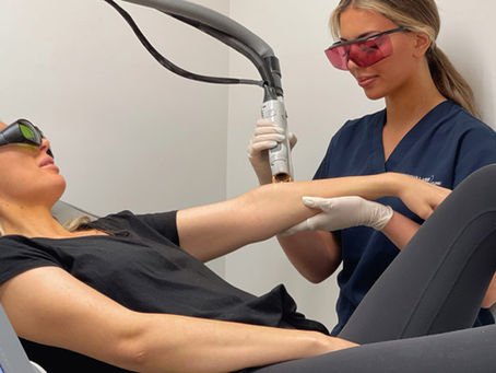 Skin Laser Treatment Melbourne