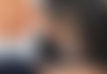 你有否脱髮問題?