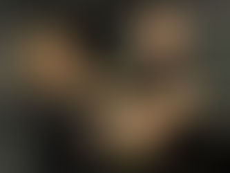 Sub Acromial Pain Syndrome 