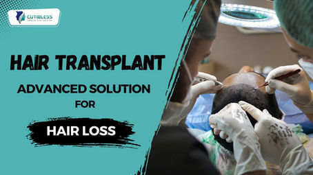 Hair Transplant: The Advanced Solution for Hair Loss at Cutibless, Bangalore