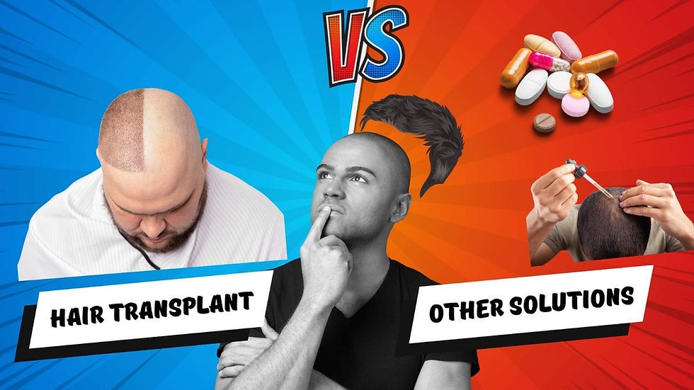 Hair Transplant vs Temporary Solutions