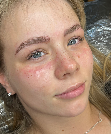 Faux Freckles bei junger Frau in Stuttgart.