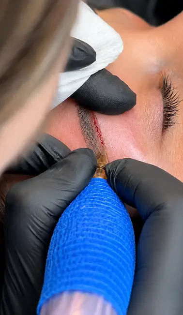 Nahaufnahme einer Saline Removal Behandlung zur PMU Entfernung alter Augenbrauen Pigmente ohne Laser