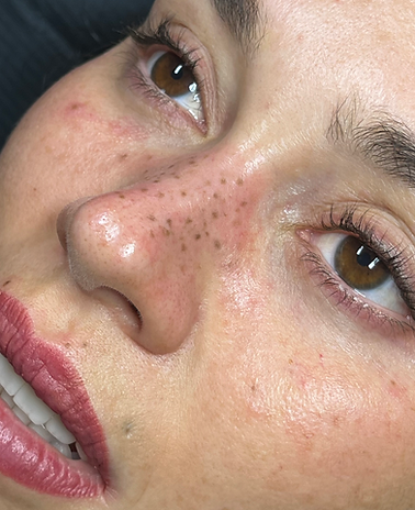 Nahaufnahme eines Gesichts mit Faux Freckles