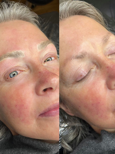 Frau vor und nach Microblading Behandlung