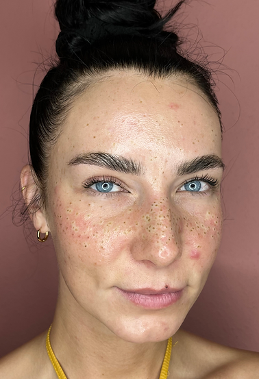 Frau mit Faux Freckles und blauen Augen