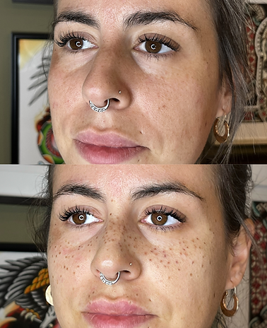 Faux Freckles Stuttgart: Vorher-Nachher-Bild einer Frau