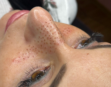 Faux Freckles auf der Nase