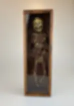 Thumbnail: 19th CENTURY DECAYING CORPSE MEMENTO MORI