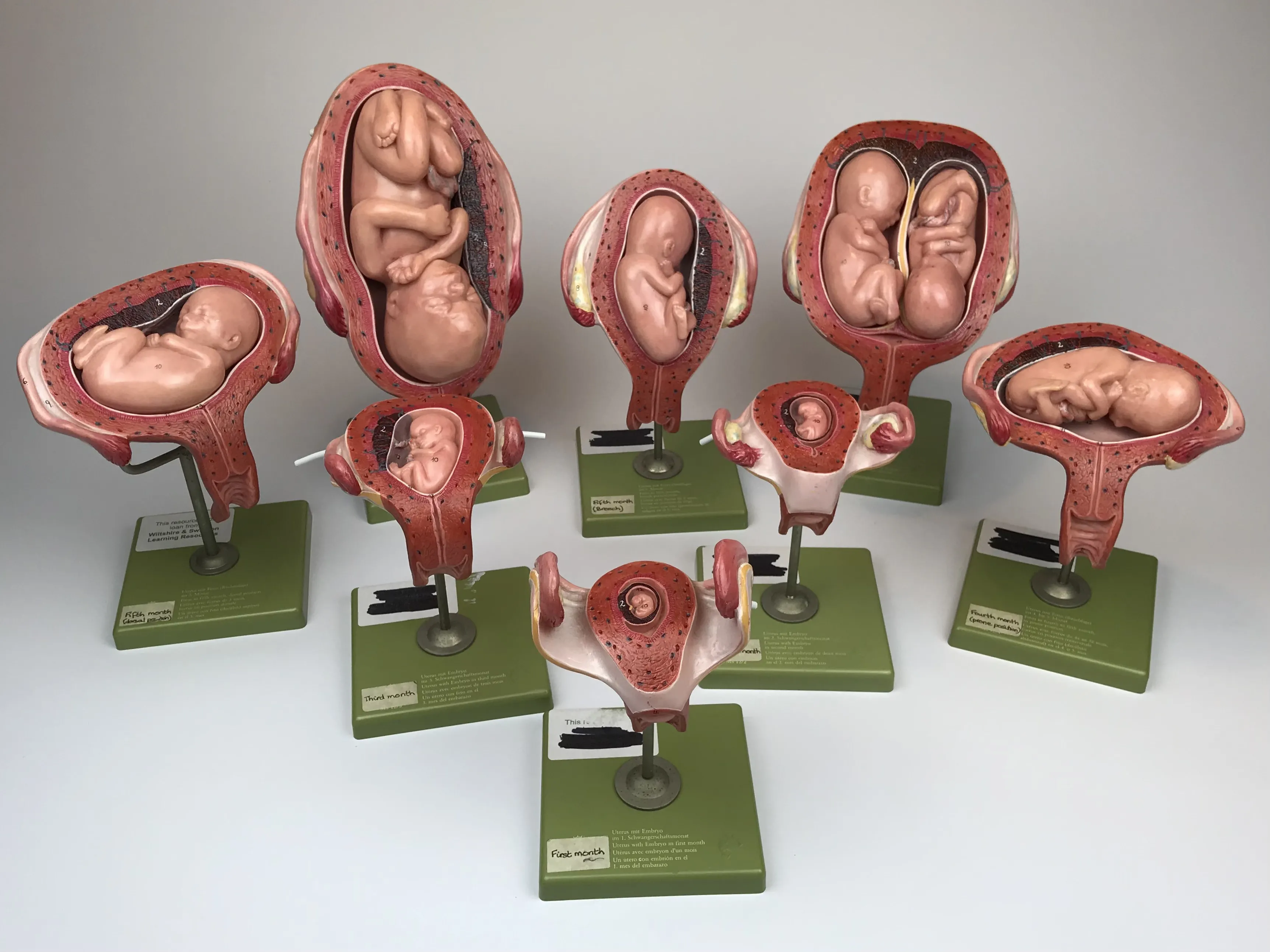 VINTAGE ANATOMICAL MODEL SET SHOWING PREGNANCY by SOMSO-MODELLE