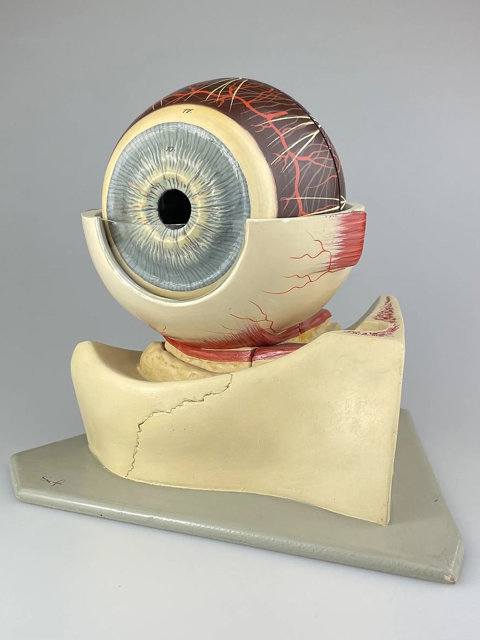 Thumbnail: ANATOMICAL MODEL of the HUMAN EYEBALL by SOMSO