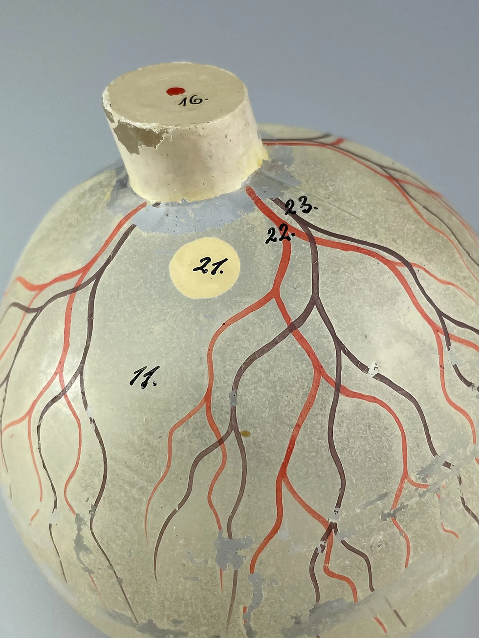 Thumbnail: ANATOMICAL MODEL of the HUMAN EYEBALL by SOMSO