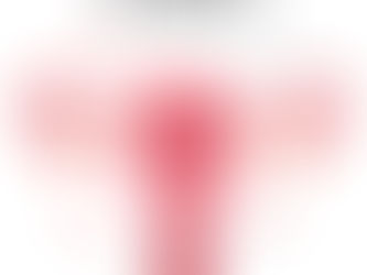 Endometriose e Musculação: O que Você Precisa Saber