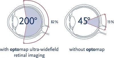 Illustration of ultra-wide field retinal image