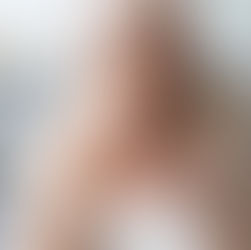 A woman holding her eyes to release pressure and pain that she fee;s as a result of glaucoma