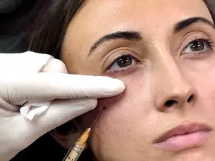 What Patients Can Expect from All-Natural PRF EZ Gel
