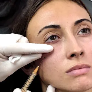 What Patients Can Expect from All-Natural PRF EZ Gel