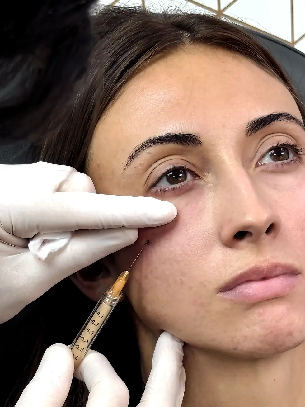 What Patients Can Expect from All-Natural PRF EZ Gel