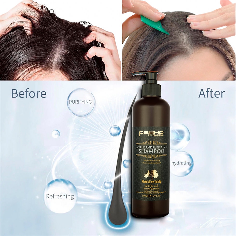 Thumbnail: ANTI DANDRUFF 2 in 1 SHAMPOO