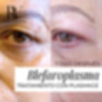 Antes y después tratamiento mirada cansada Concepción