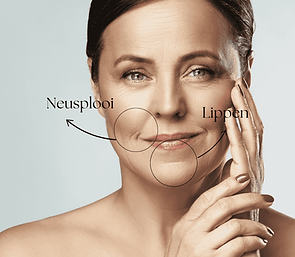 radiofrequentie-neusplooi-lippenNeusplooi Lippen.png