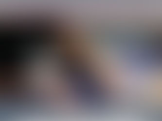 Anuncia SSM jornada de vasectomías sin bisturí, en Uruapan