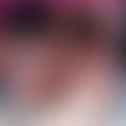 SSM Entrega 1,228 auxiliares auditivos gratuitos