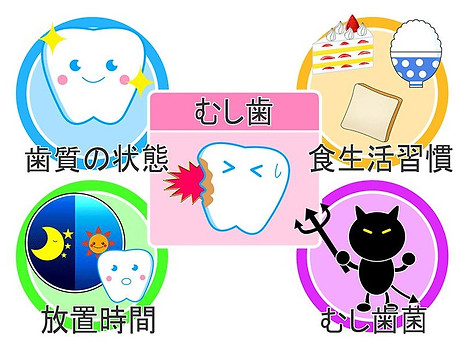 虫歯イメージ図