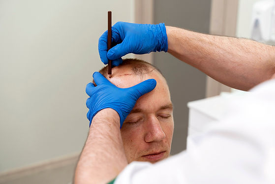mature-man-having-balding-problems.jpg