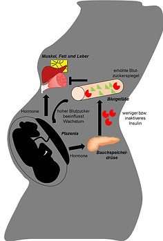 Stoffwechsel-Schwangerschaftsdiabetes.jpg