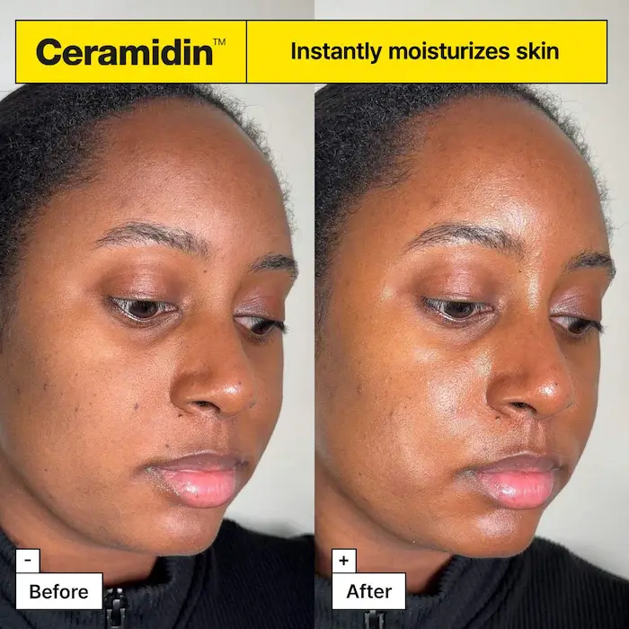 Miniatura: Crema hidratante de barrera cutánea Ceramidin™
