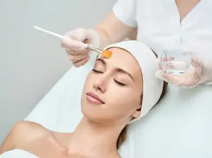 What Factors Should I Consider When Choosing a Provider for a Chemical Peel?