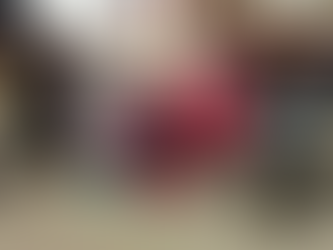 MOTOCICLISTA SE IMPACTA CONTRA UNA CAMIONETA