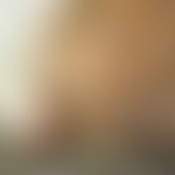 Mujer de blusa beige sacando los retenedores Vivera del estuche blanco