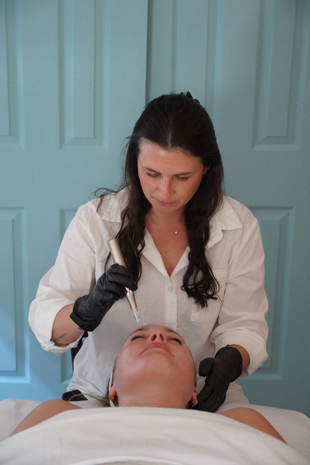 Aesthetician performing facial acupuncture treatment