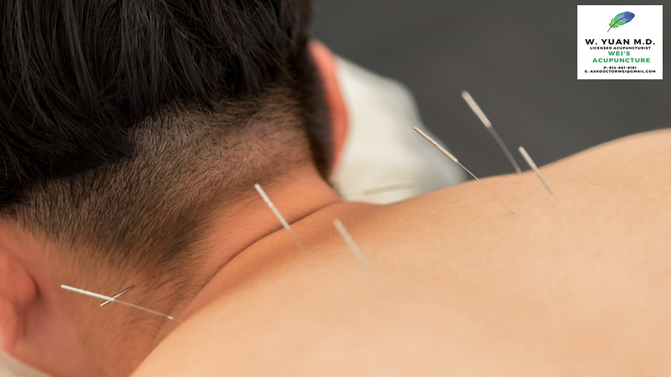 Patient receiving Acupuncture For Neck Pain in New York to relieve chronic neck stiffness, improve mobility, and reduce pain naturally.