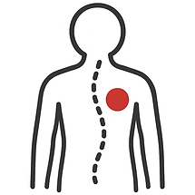 Scoliosis management with chiropractic treatment in Concord