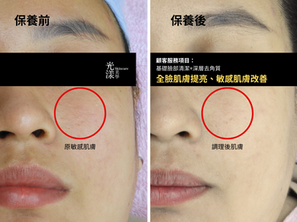敏感肌也能擁有水潤透亮肌!蘆薈美容體驗分享