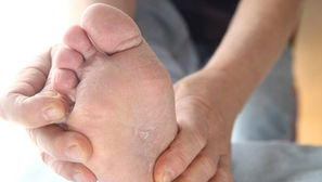 癢、癢、癢,討厭的香港腳,只要用它,就可以跟香港腳說掰掰